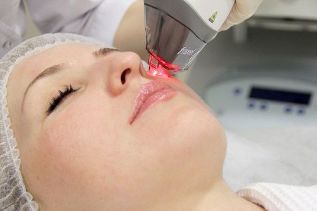Ansiktshudföryngringsprocess med fraktionerad laser