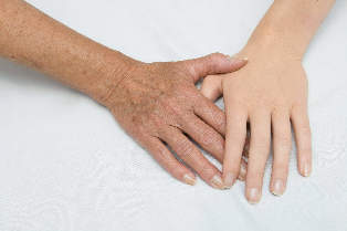 föryngring av huden på händer