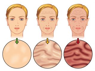 stadier av åldrande hud